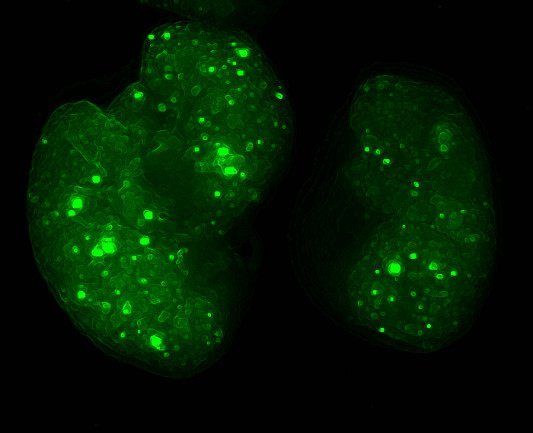 Reconstrucción digital de la distribución de exosomas tumorales (en verde) en pulmones de ratón durante la formación del nicho pre-metastásico. Imagen de Héctor Peinado/CNIO.