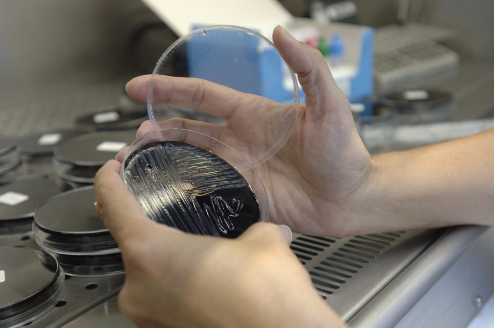 Zaragoza.- Una muestra, recogida en las torres de refrigeración del centro de Zaragoza, es analizada en los laboratorios de la Dirección General de Salud del Gobierno de Aragón en busca del foco de legionela. EFE/Javier Belver
