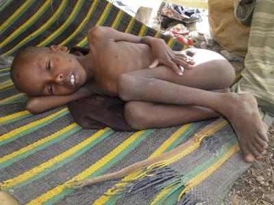 Un niño enfermo por los efectos de la sequía en Somalia. 