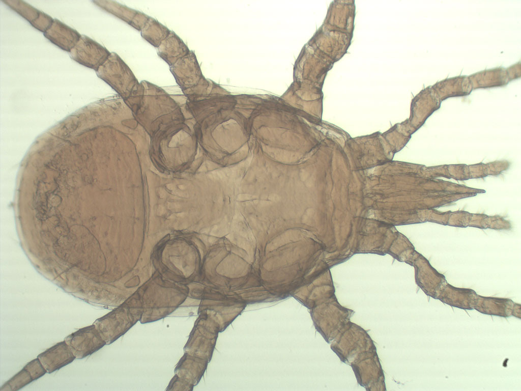 Lasioseius (Endopodalius) ibericus /Moraza & Balanzategui 2023